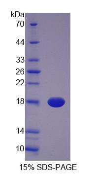 胆绿素还原酶A(BLVRA)重组蛋白,Recombinant Biliverdin Reductase A (BLVRA)