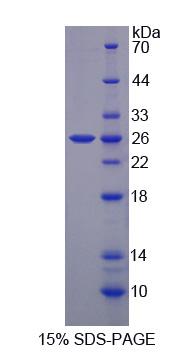 膽綠素還原酶B(BLVRB)重組蛋白,Recombinant Biliverdin Reductase B (BLVRB)