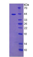 胆囊收缩素(CCK)重组蛋白,Recombinant Cholecystokinin (CCK)