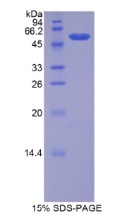 胆盐依赖性脂肪酶(BSDL)重组蛋白,Recombinant Lipase, Bile Salt Dependent (BSDL)