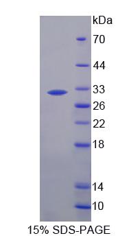 弹性蛋白酶2A(ELA2A)重组蛋白,Recombinant Elastase 2A (ELA2A)