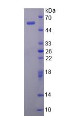 彈性蛋白酶3A(ELA3A)重組蛋白,Recombinant Elastase 3A (ELA3A)