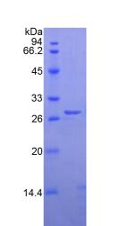 彈性蛋白酶3B(ELA3B)重組蛋白,Recombinant Elastase 3B (ELA3B)