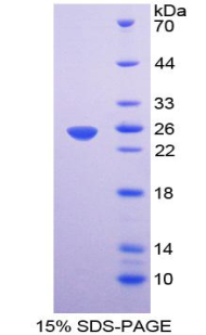 弹性蛋白微原纤维界面因子1(EMILIN1)重组蛋白,Recombinant Elastin Microfibril Interface Located Protein 1 (EMILIN1)