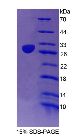 彈性蛋白微原纖維界面因子2(EMILIN2)重組蛋白,Recombinant Elastin Microfibril Interface Located Protein 2 (EMILIN2)