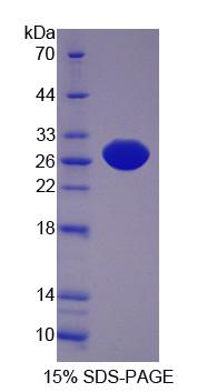 蛋白L-异天冬氨酸-O-甲基转移酶(PCMT1)重组蛋白,Recombinant Protein L-Isoaspartate-O-Methyltransferase (PCMT1)