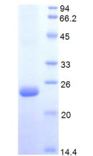 蛋白S(PROS)重組蛋白,Recombinant Protein S (PROS)