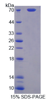 蛋白Z(PROZ)重組蛋白,Recombinant Protein Z (PROZ)