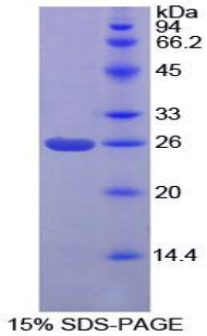 蛋白激酶C相互作用蛋白1(PICK1)重组蛋白,Recombinant Protein Interacting With C Kinase 1 (PICK1)