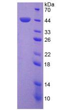 蛋白激酶Cδ(PKCd)重组蛋白,Recombinant Protein Kinase C Delta (PKCd)