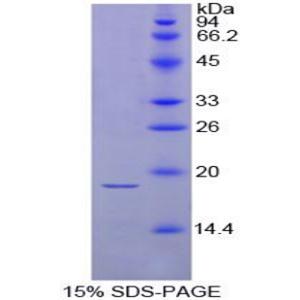 促甲狀腺素β(TSHb)重組蛋白,Recombinant Thyroid Stimulating Hormone Beta (TSHb)