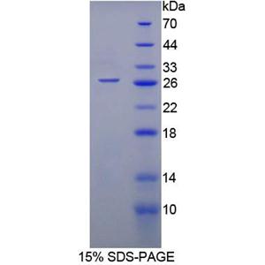 单氨氧化酶A(MAOA)重组蛋白,Recombinant Monoamine Oxidase A (MAOA)