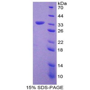 单核细胞趋化蛋白3(MCP3)重组蛋白