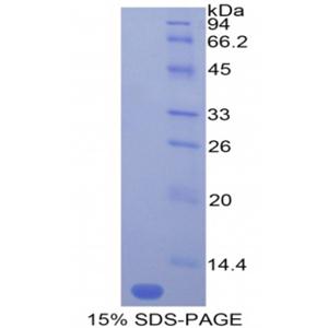 单核细胞趋化蛋白5(MCP5)重组蛋白,Recombinant Monocyte Chemotactic Protein 5 (MCP5)