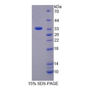 单链选择性单功能尿嘧啶DNA糖基化酶1(SMUG1)重组蛋白