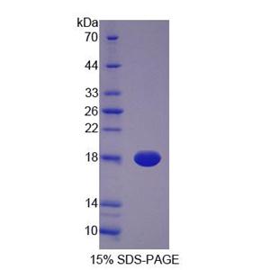 胆绿素还原酶A(BLVRA)重组蛋白,Recombinant Biliverdin Reductase A (BLVRA)