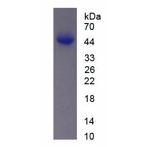 膽囊收縮素4(CCK4)重組蛋白