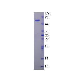 弹性蛋白酶3A(ELA3A)重组蛋白