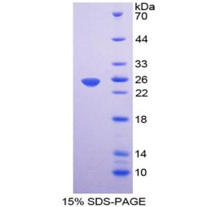 弹性蛋白微原纤维界面因子1(EMILIN1)重组蛋白,Recombinant Elastin Microfibril Interface Located Protein 1 (EMILIN1)