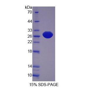 蛋白L-异天冬氨酸-O-甲基转移酶(PCMT1)重组蛋白,Recombinant Protein L-Isoaspartate-O-Methyltransferase (PCMT1)