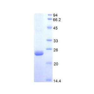 蛋白S(PROS)重组蛋白