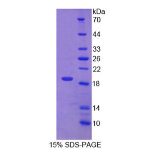 蛋白二硫化物异构酶A5(PDIA5)重组蛋白