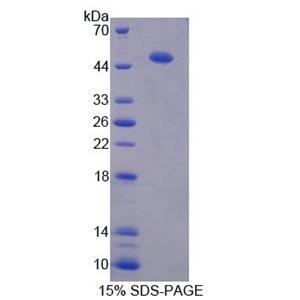 蛋白二硫化物异构酶A6(PDIA6)重组蛋白