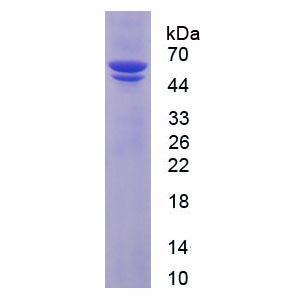 蛋白二硫键异构酶(PDI)重组蛋白