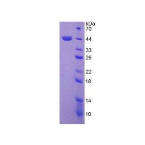 蛋白激酶Cδ(PKCd)重组蛋白,Recombinant Protein Kinase C Delta (PKCd)