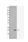 IL1RN Antibody