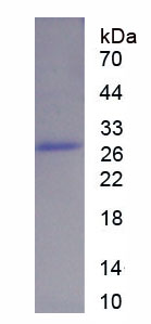 蛋白激酶Cζ(PKCz)重组蛋白,Recombinant Protein Kinase C Zeta (PKCz)