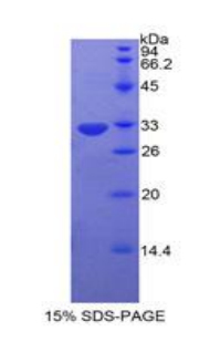 蛋白激酶Cη(PKCh)重组蛋白,Recombinant Protein Kinase C Eta (PKCh)