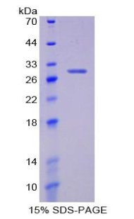 蛋白激酶Cι(PKCi)重組蛋白,Recombinant Protein Kinase C Iota (PKCi)