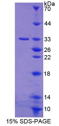 蛋白激酶D3(PKD3)重组蛋白,Recombinant Protein Kinase D3 (PKD3)