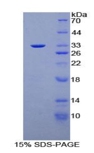 蛋白激酶N1(PKN1)重组蛋白,Recombinant Protein Kinase N1 (PKN1)