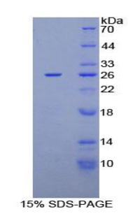 蛋白激酶N2(PKN2)重组蛋白,Recombinant Protein Kinase N2 (PKN2)