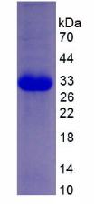 蛋白激酶R(PKR)重组蛋白,Recombinant Protein Kinase R (PKR)