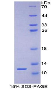 蛋白激酶抑制因子γ(PKIg)重组蛋白,Recombinant Protein Kinase Inhibitor Gamma (PKIg)