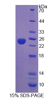 蛋白酪氨酸磷酸酶ⅣA3(PTP4A3)重组蛋白,Recombinant Protein Tyrosine Phosphatase Type IVA 3 (PTP4A3)