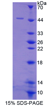 蛋白磷酸酶3调节因子亚基1(PPP3R1)重组蛋白,Recombinant Protein Phosphatase 3, Regulatory Subunit 1 (PPP3R1)