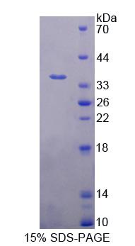 蛋白酶激活亚基3(PSME3)重组蛋白,Recombinant Proteasome Activator Subunit 3 (PSME3)