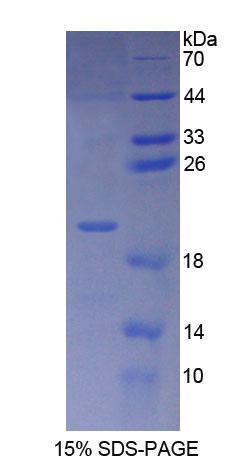 蛋白酶体成熟蛋白(POMP)重组蛋白,Recombinant Proteasome Maturation Protein (POMP)