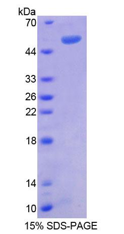 蛋白信號(hào)調(diào)節(jié)因子1(RGS1)重組蛋白,Recombinant Regulator Of G Protein Signaling 1 (RGS1)