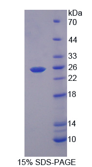 蛋白信號調(diào)節(jié)因子5(RGS5)重組蛋白,Recombinant Regulator Of G Protein Signaling 5 (RGS5)