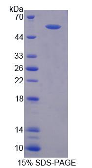 蛋白信号调节因子6(RGS6)重组蛋白,Recombinant Regulator Of G Protein Signaling 6 (RGS6)