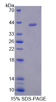 低密度脂蛋白受体衔接蛋白1(LDLRAP1)重组蛋白,Recombinant Low Density Lipoprotein Receptor Adaptor Protein 1 (LDLRAP1)