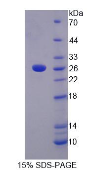 低密度脂蛋白受体相关蛋白3(LRP3)重组蛋白,Recombinant Low Density Lipoprotein Receptor Related Protein 3 (LRP3)