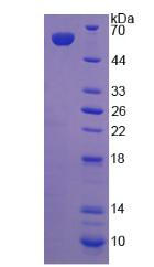 低密度脂蛋白受體相關(guān)蛋白4(LRP4)重組蛋白,Recombinant Low Density Lipoprotein Receptor Related Protein 4 (LRP4)