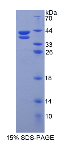 抵抗素样蛋白β(RETNLb)重组蛋白,Recombinant Resistin Like Beta (RETNLb)