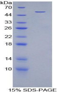 碘甲腺原氨酸脱碘酶Ⅲ(DIO3)重组蛋白,Recombinant Deiodinase, Iodothyronine, Type III (DIO3)